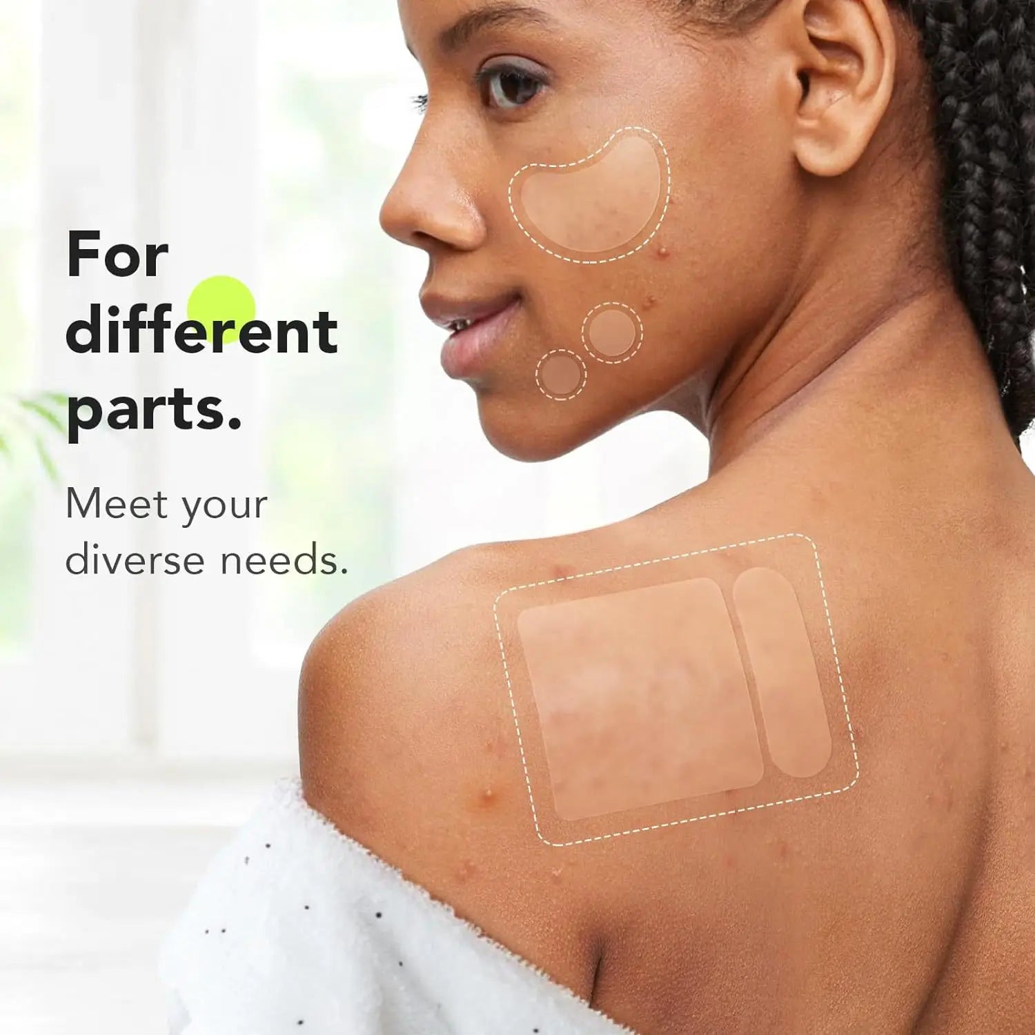 Hydrogel acne removing patch (4 shapes), 180 pieces/box, deep cleaning acne removing patch, effective acne removing patch Oasis Select