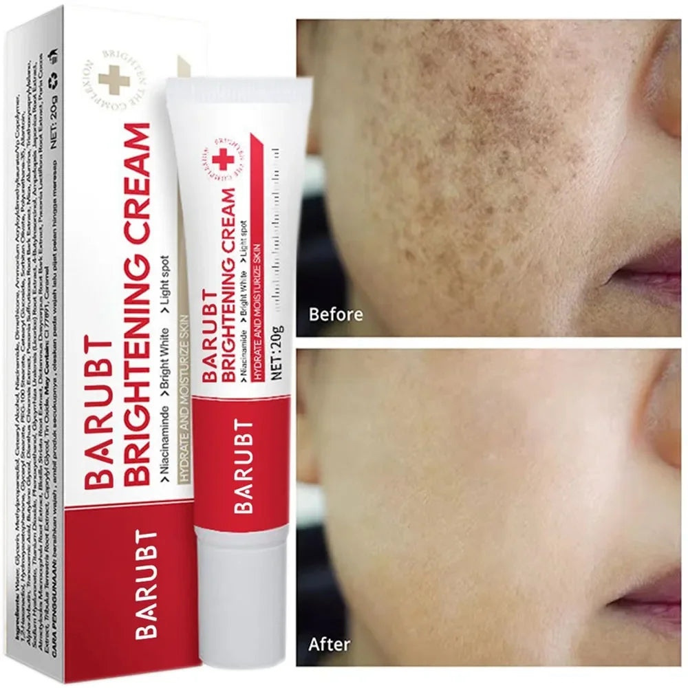 Brightening Face Cream – Dark Spot Corrector & Pigmentation
