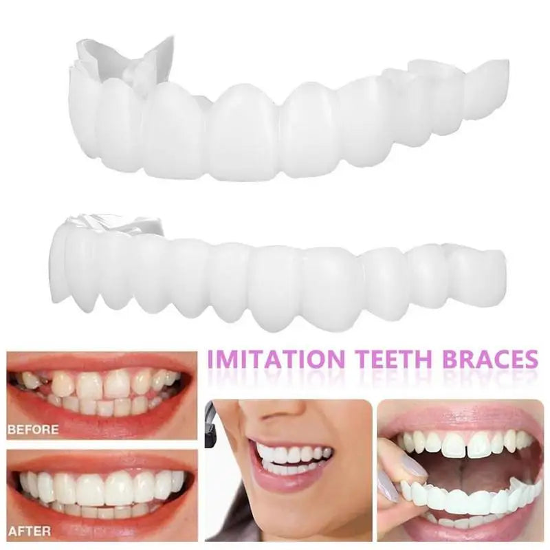 Snap-On Teeth Veneers – Reusable Smile Cover for Men & Women Cosmetic Dental Veneers Oasis Select