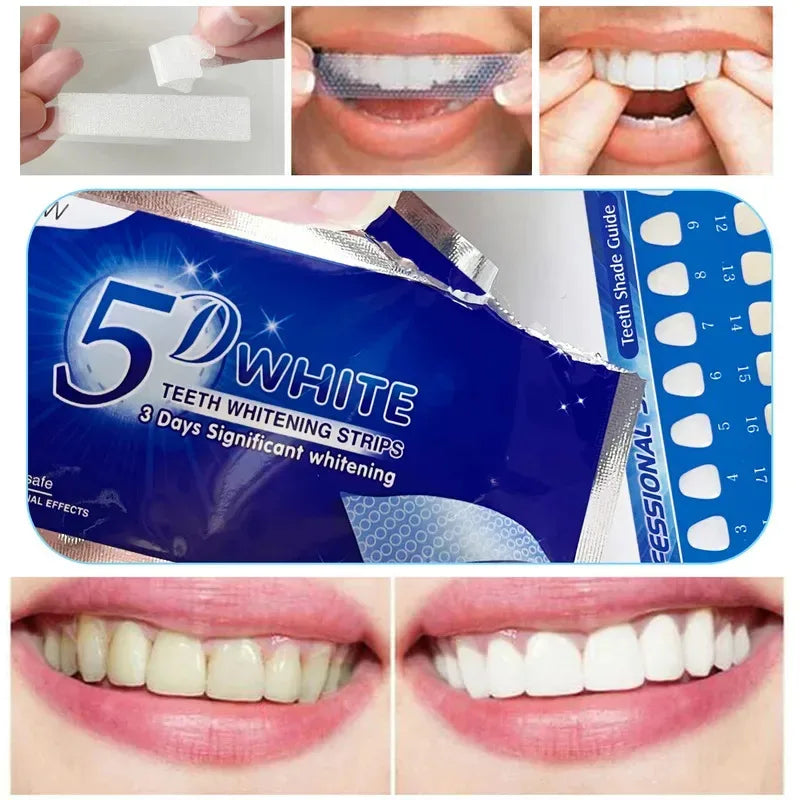 1/3/6pairs Silicone Mouth Guard Sleeping Mouth Guard Tray Orthodontic Braces Set For Bruxism Non-Snoring Teeth Whitening Protect Oasis Select