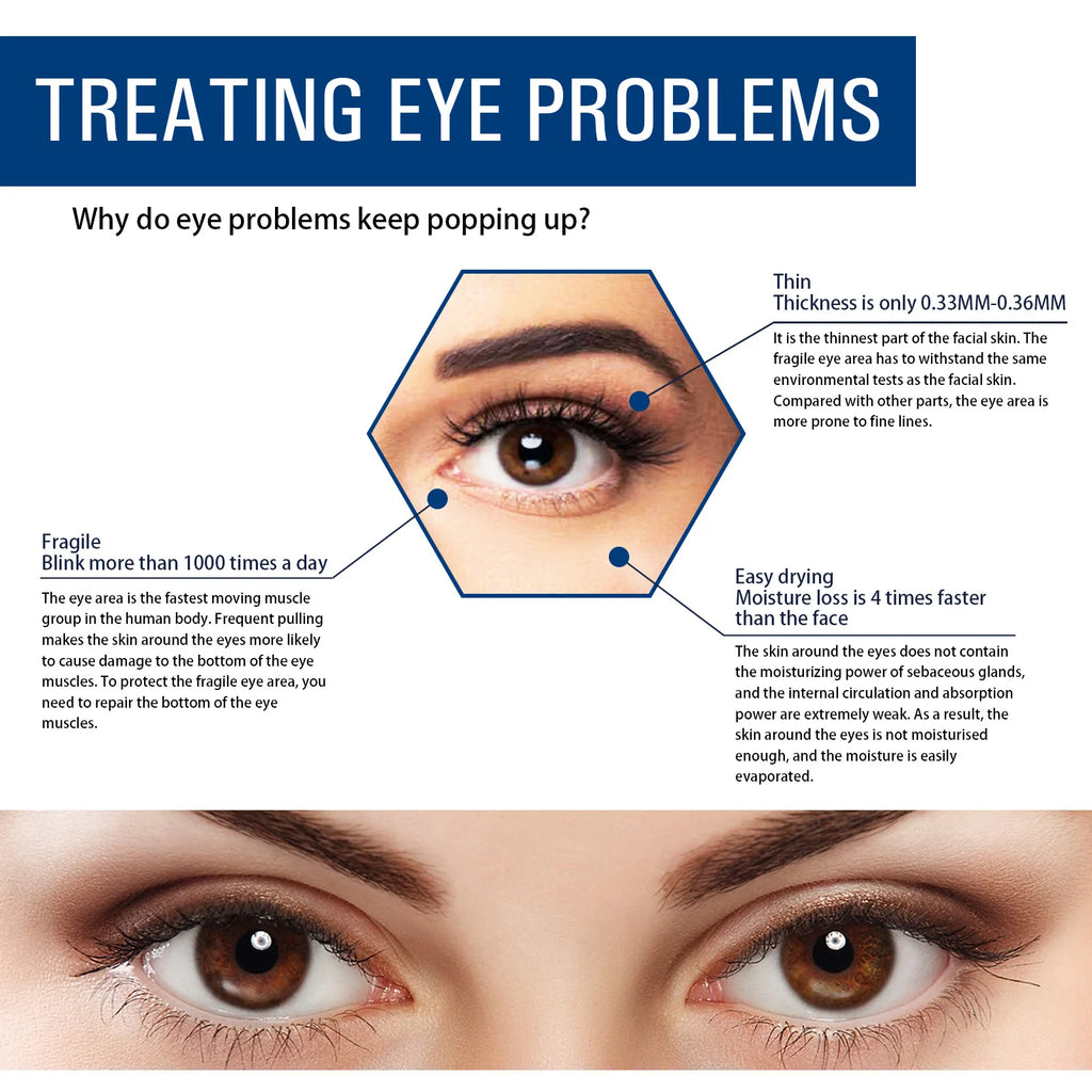 Eelhoe Anti-Aging Eye Serum – Dark Circles & Fine Lines