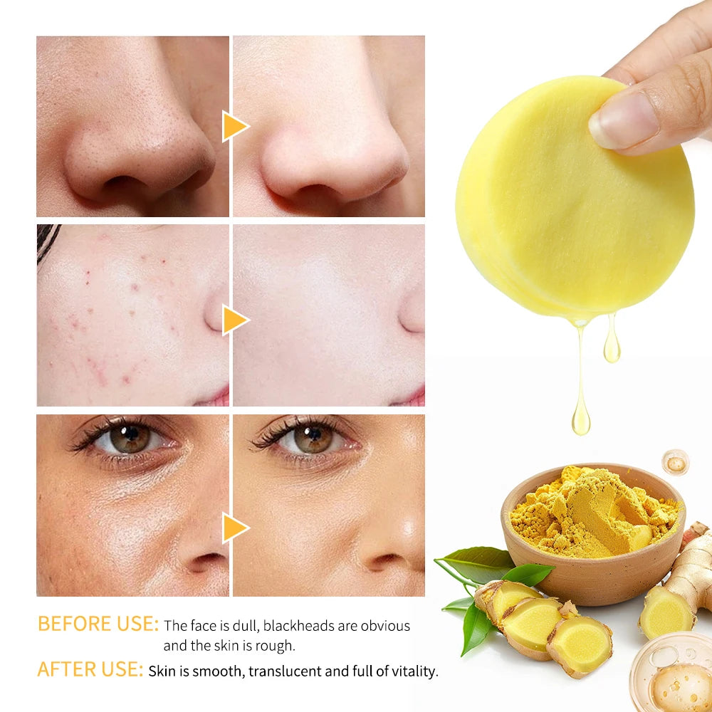 Turmeric & Kojic Acid Exfoliating Cleansing Pads – 80 Pack Exfoliating Cleansing Pads Oasis Select