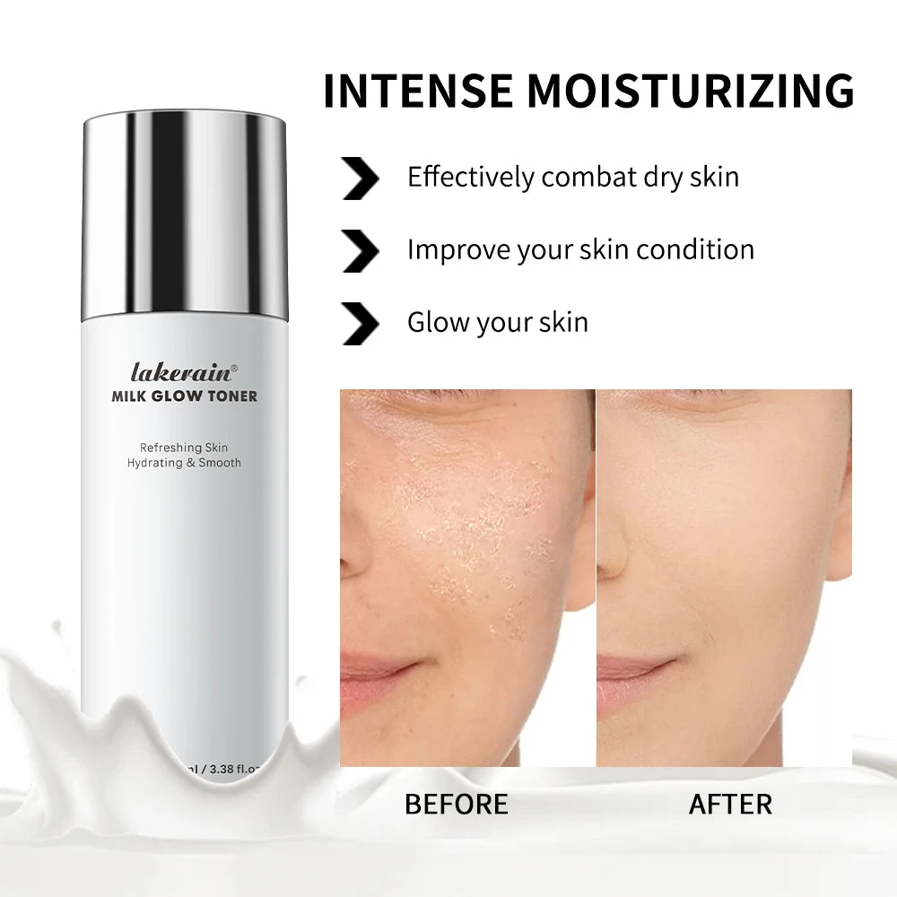 Milk Soothing Toner Moisturizing Water For Face Facial Toner Natural Houttuynia Cordata Extract Refresh Claming Skin Oasis Select