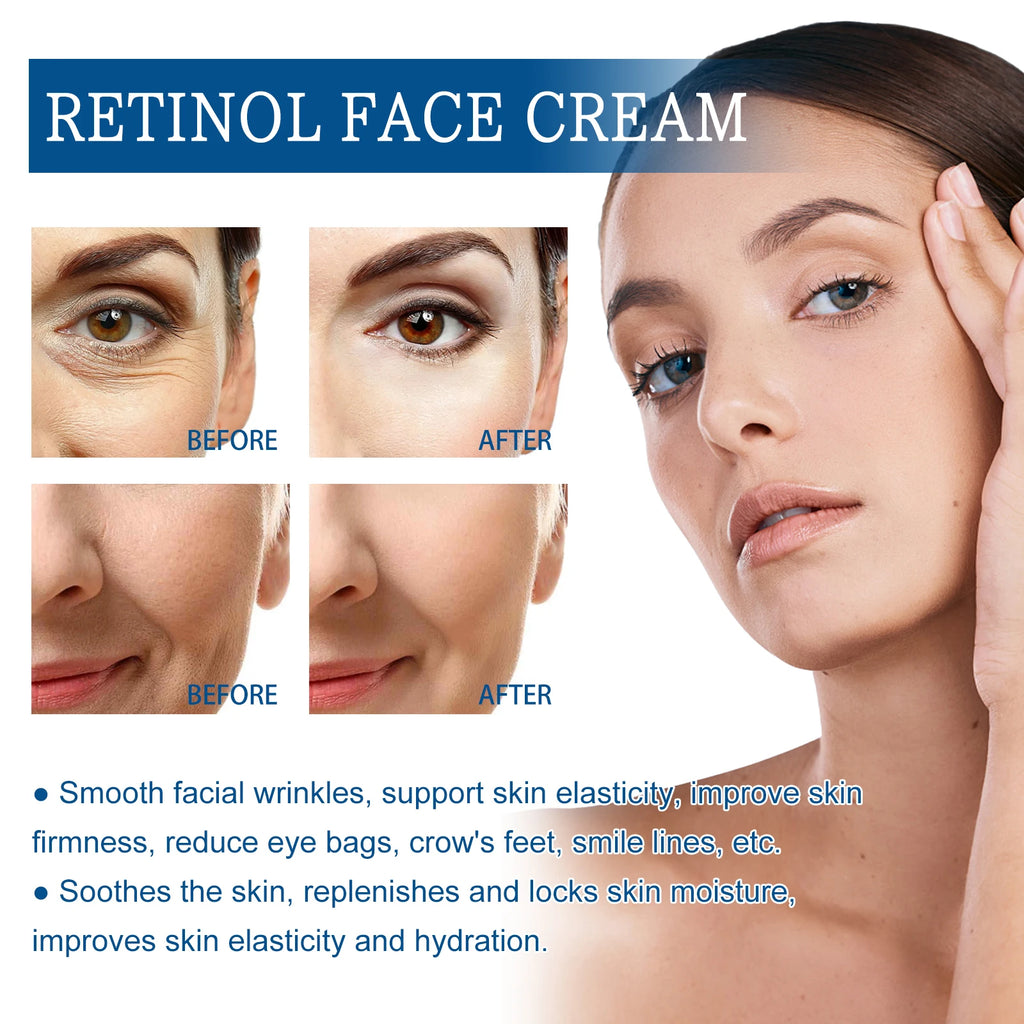 Retinol Anti Aging Face Cream Lifting Firming Fade Dark Spot Line Tightening Smoothing Facial Skin Care Wrinkles Removal Cream Oasis Select