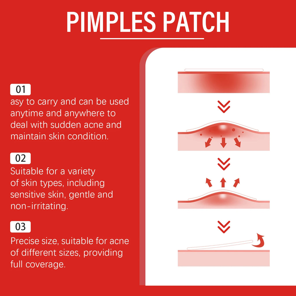 240pc Salicylic Acid Acne Pimple Patches – Fun Shapes Acne Pimple Patches Oasis Select