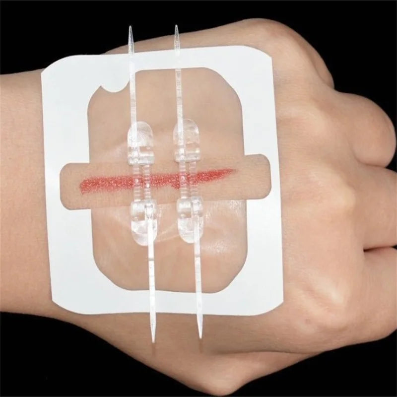 Emergency Wound Closure Zip Stitch Sutures Bandaids Repair Wounds Without Stitches For Outdoor Activities Quick Clot Wound Oasis Select