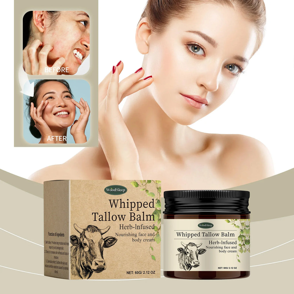 Moisturizing Whipped Tallow Balm Dry Sensitive Skin Long Lasting Hydration Gentle Tallow Cream Body Face Care Winter Moisturizer Oasis Select