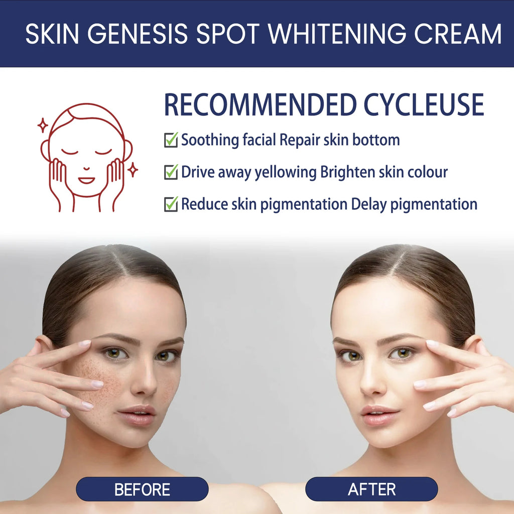 Hoygi Brightening Spot Fade Moisturizer – Dark Spot Cream