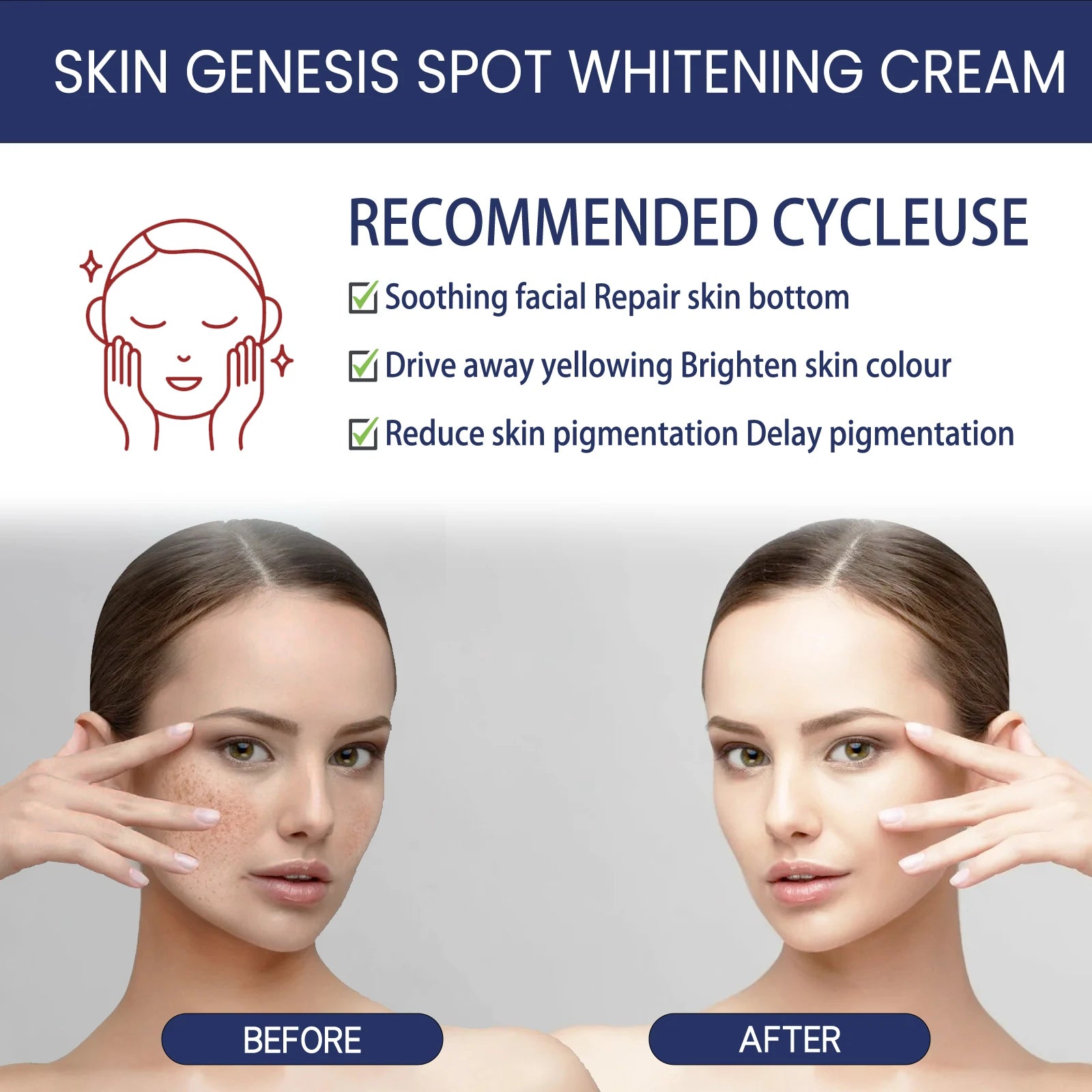 Hoygi Brightening Spot Fade Moisturizer – Dark Spot Cream