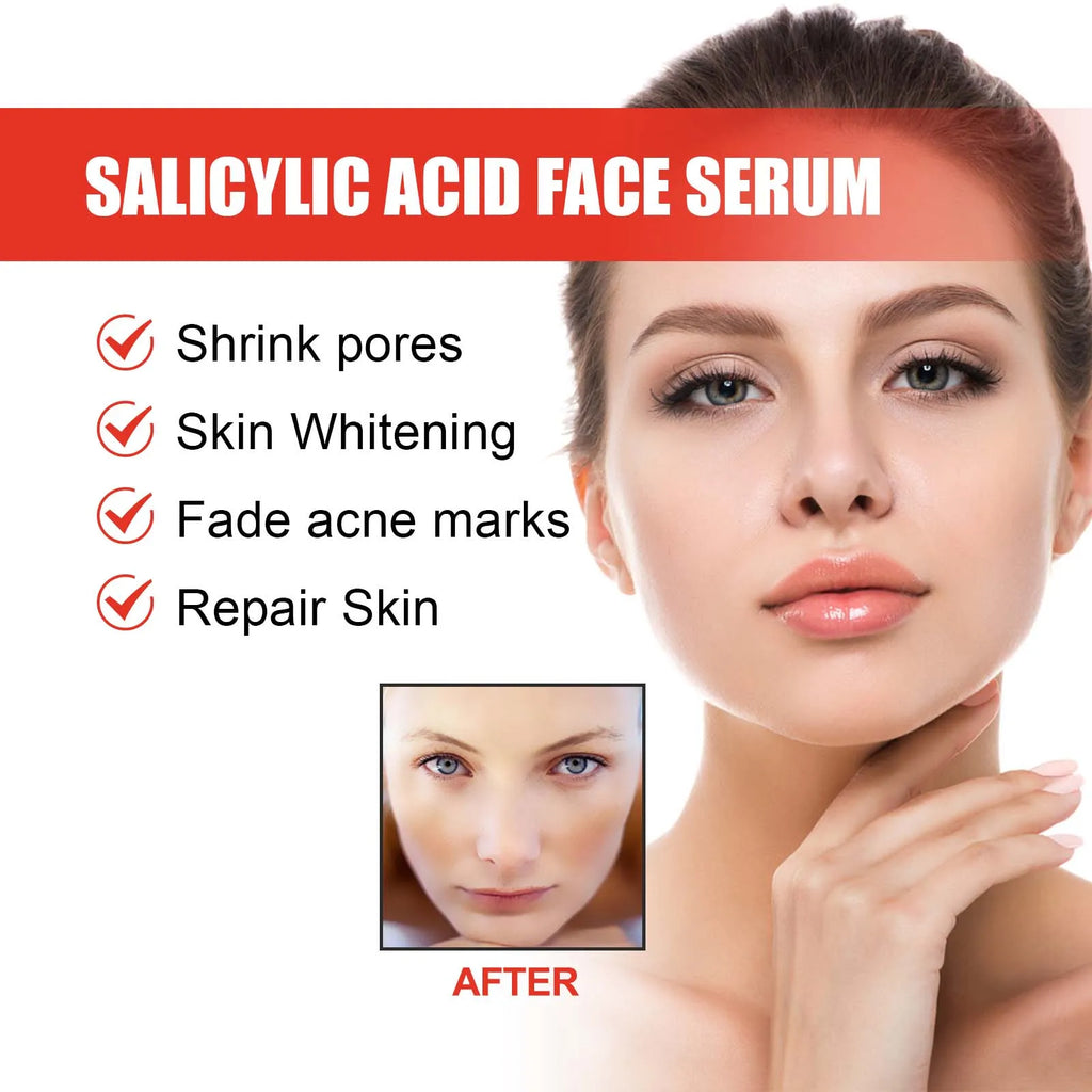 Salicylic Acid & Niacinamide Face Serum – Pore & Acne Scar Face Serum Oasis Select