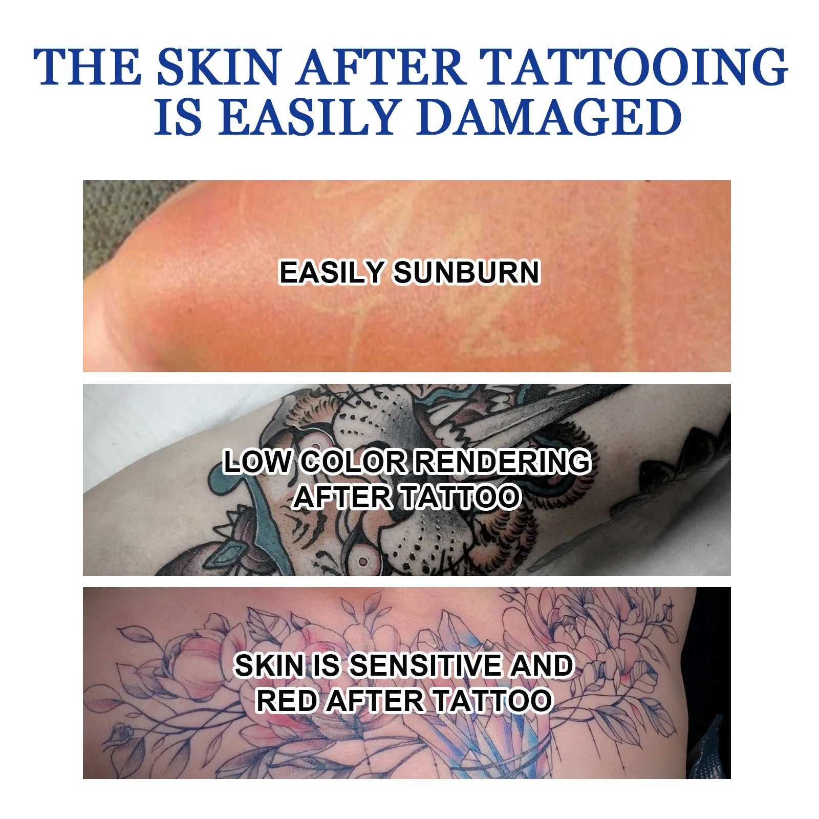 OceAura Tattoo Removal Gel – Painless Fading & Skin Repair Tattoo Removal Gel Oasis Select