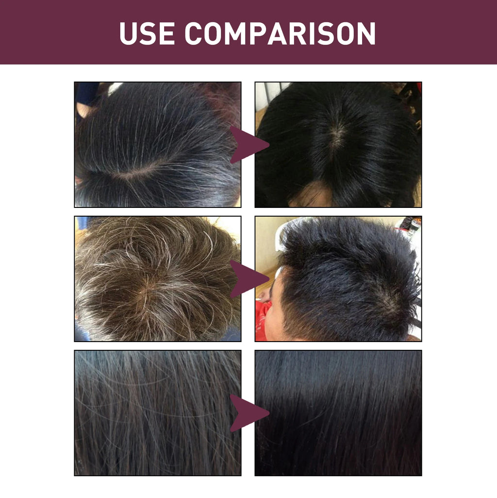 Polygonum Multiflorum Shampoo Soap Remove Dandruff Reduct Hair Loss Restore Natural Black Hair Strengthen Hair Roots Hair Care Oasis Select
