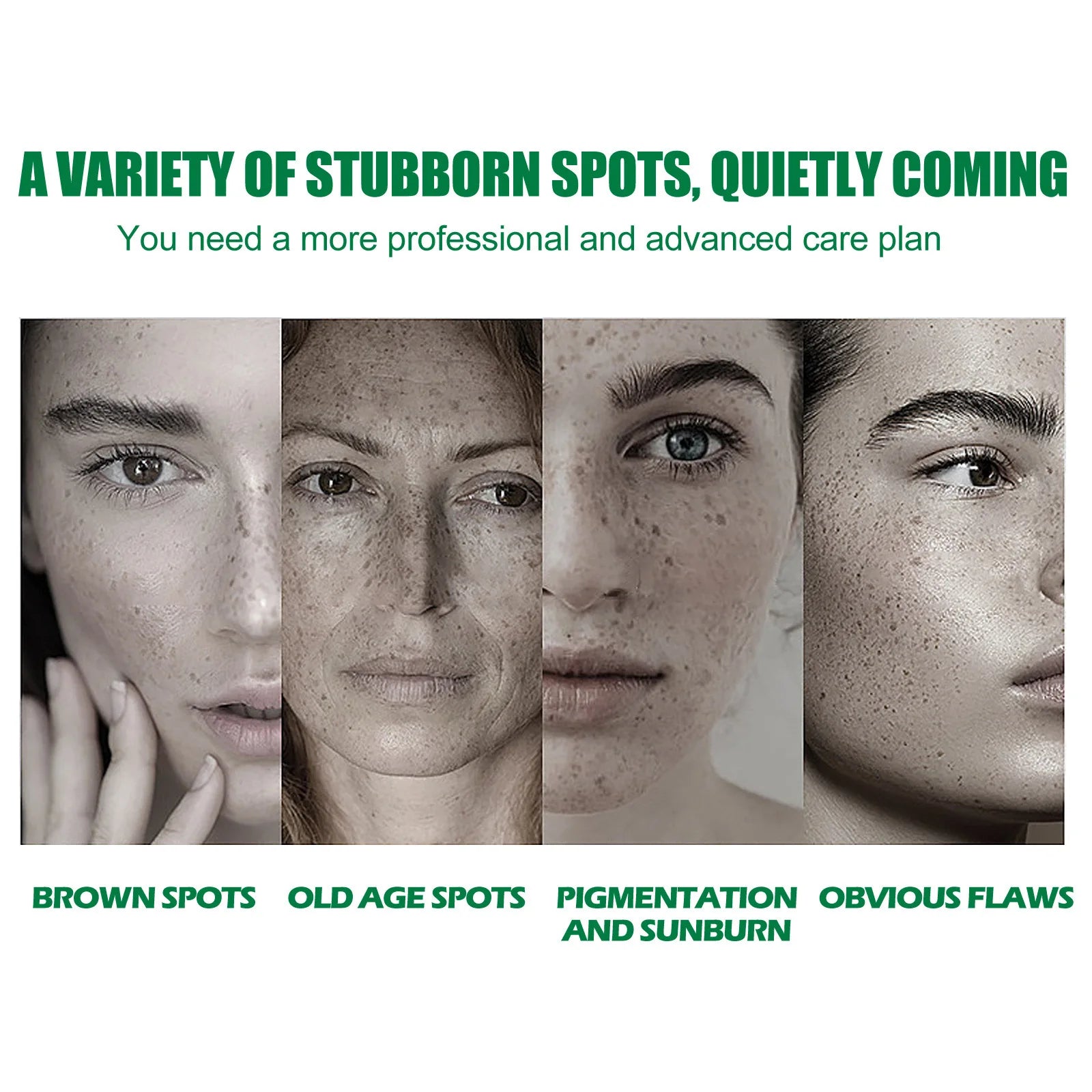 Dark Spot Correcting Glow Serum Fade Pigment Freckle Melasma Melanin Improves Dull Skin Facial Whitening Brightening Essence Oasis Select