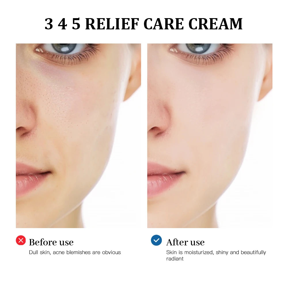 345 Relief Cream solution to skin problems Anti-sugar and antioxidant Address Blemishes Nourish Long lasting Moisturizer Korean Oasis Select