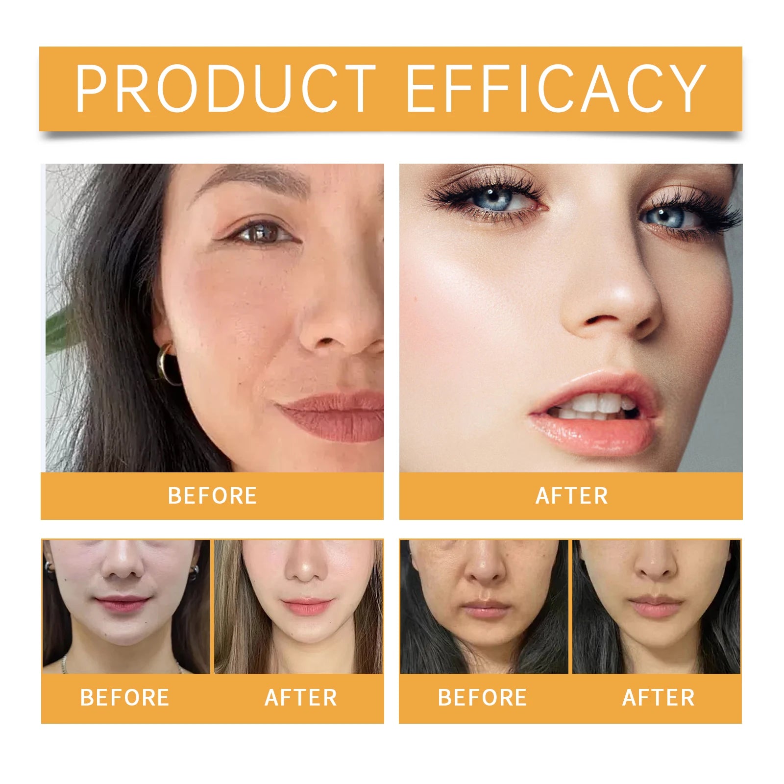 Nasolabial Folds Patch Contain Collagen Hyaluronic Acid Firming Skin Fade Fine Lines Deep Moisturizing Facial Mask Anti WrinkleA Oasis Select