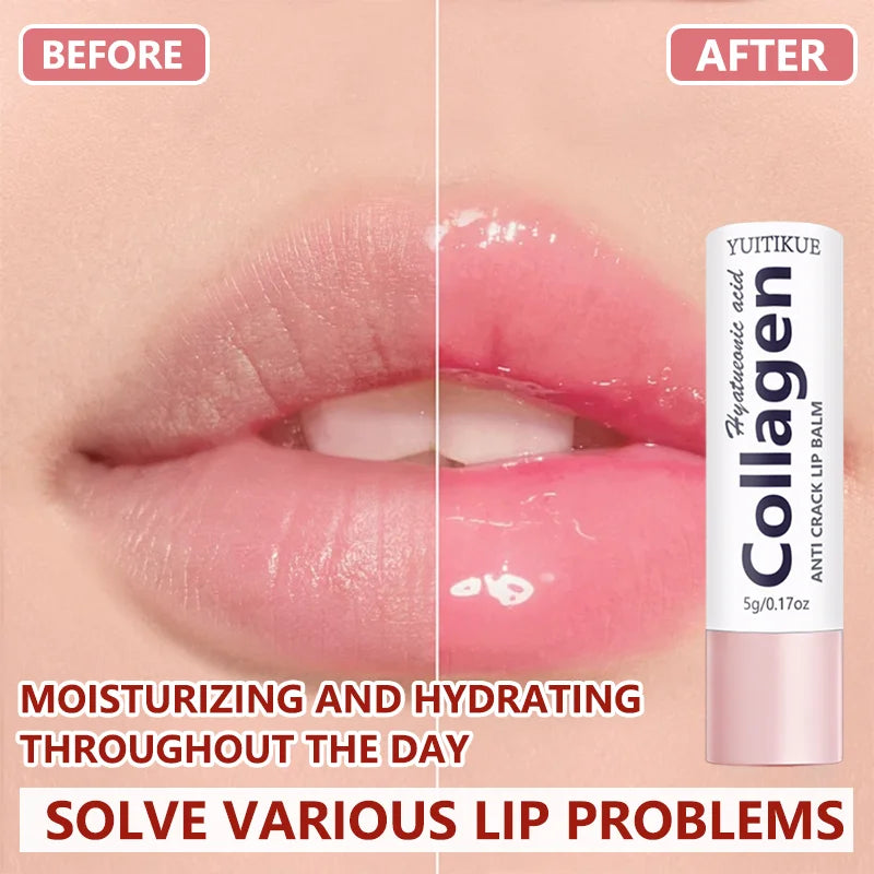 Collagen Lip Balm – Hyaluronic Acid 24H Hydration Anti-Crack