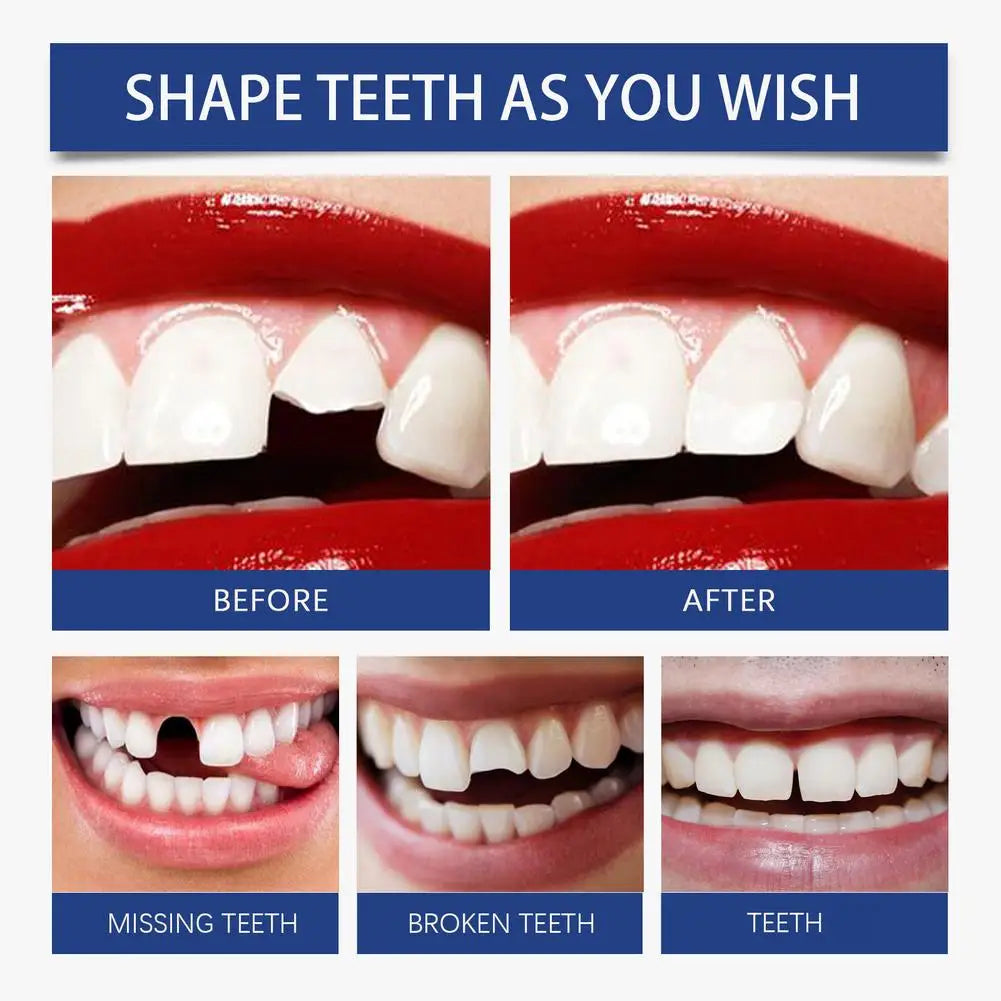 30g Fake Teeth Repair Dental Adhesive, Thermal Forming False Teeth,Reusable Super Strong Non-Toxic Dental Solution (1 Bottle) Oasis Select