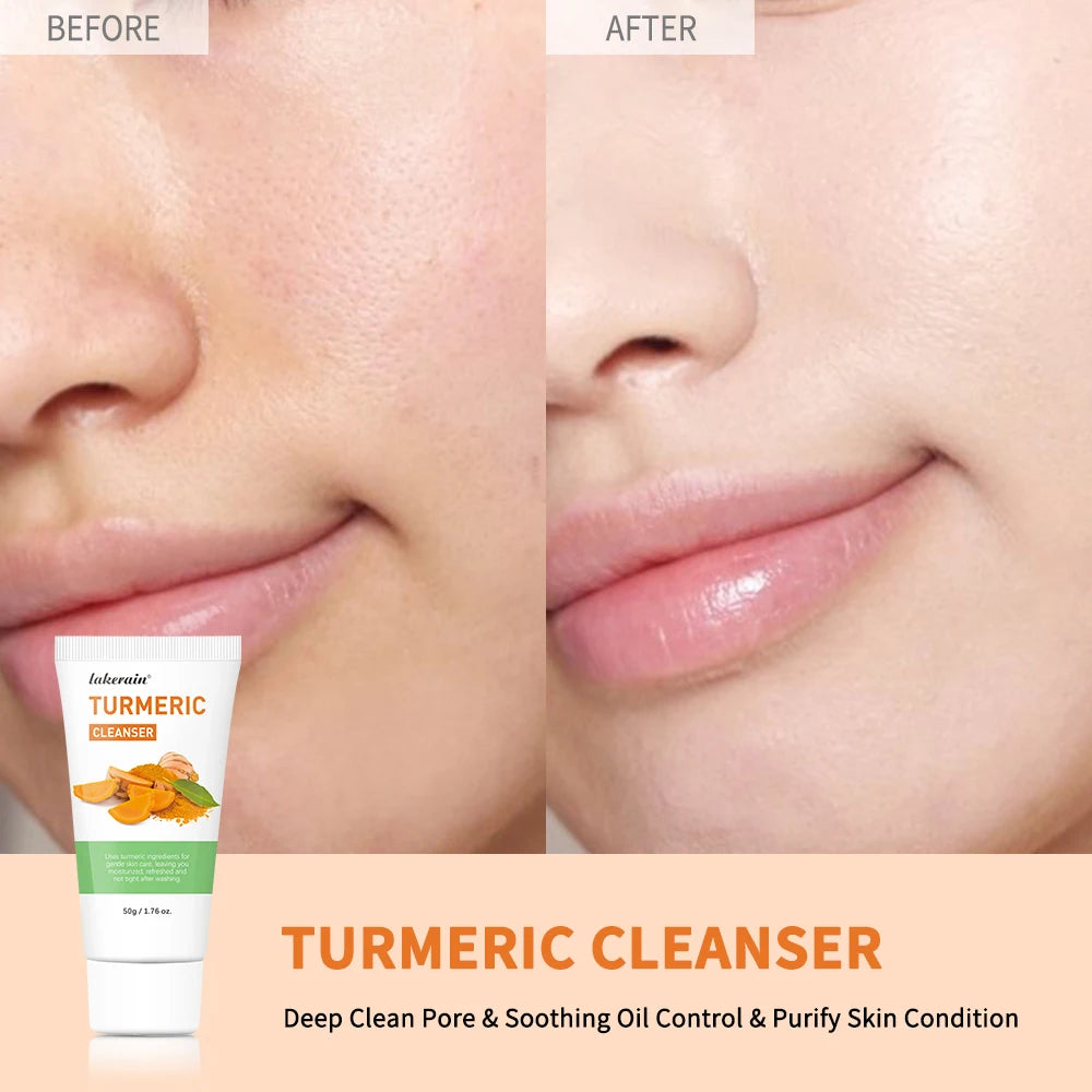 Turmeric Facial Cleanser – Oil Control, Deep Clean & Pore Refining