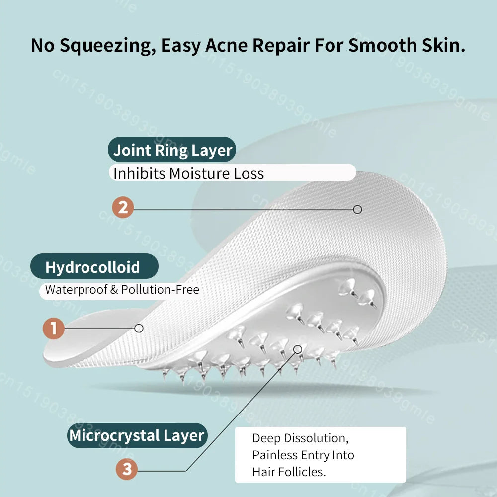 Hyaluronic Acid Microneedle Acne Patch – Invisible & Breathable