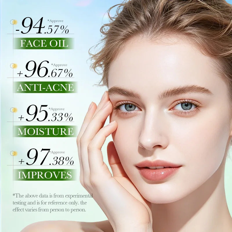 SADOER Salicylic Acid Face Cream – Oil Control & Clear Pores Acne Face Cream Oasis Select