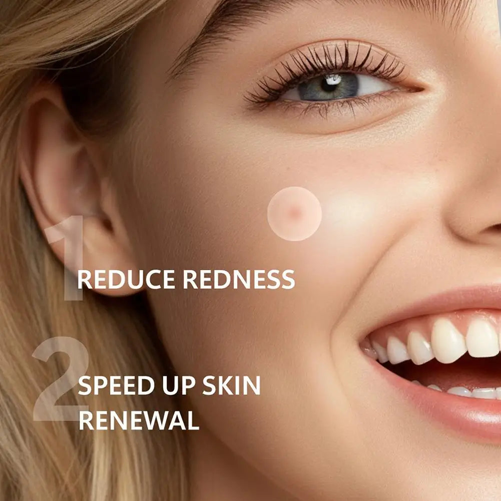 12/24pcs Acne Microneedle Patches For Overnight Use,Hydrocolloid Technology Dissolves Blemishes, Invisible Skin Care 0.2mm Oasis Select