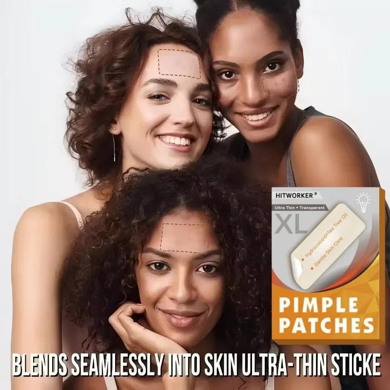 30 pieces/box transparent strip hydrocolloid concealer stickers - day and night, tasteless, alcohol free body concealer stickers Oasis Select