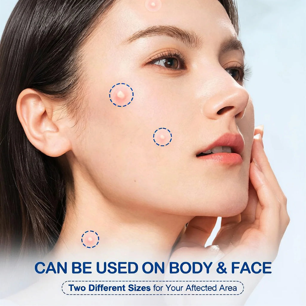 412 /824pieces of HITWORKER tea tree oil acne patch - round transparent design, makeup concealer patch, acne emergency, invisibl Oasis Select