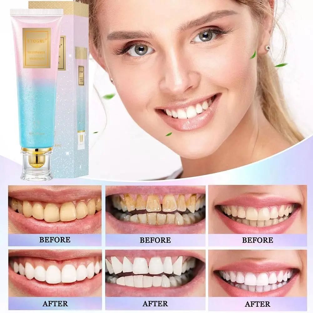 Niacinamide Whitening Toothpaste – Stain Removal & Fresh Breath