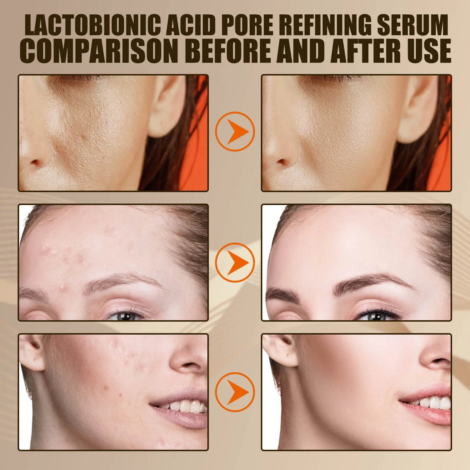 Lactose Acid Shrink Pores Serum Moisturizing Remove Blackheads Repair Face Pores Skin Firming Brighten Nourish Face Essence Oasis Select