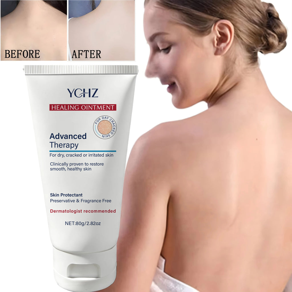 YCHZ Hydrating Body Cream – Shea Butter, Vitamin E & Hyaluronic Acid