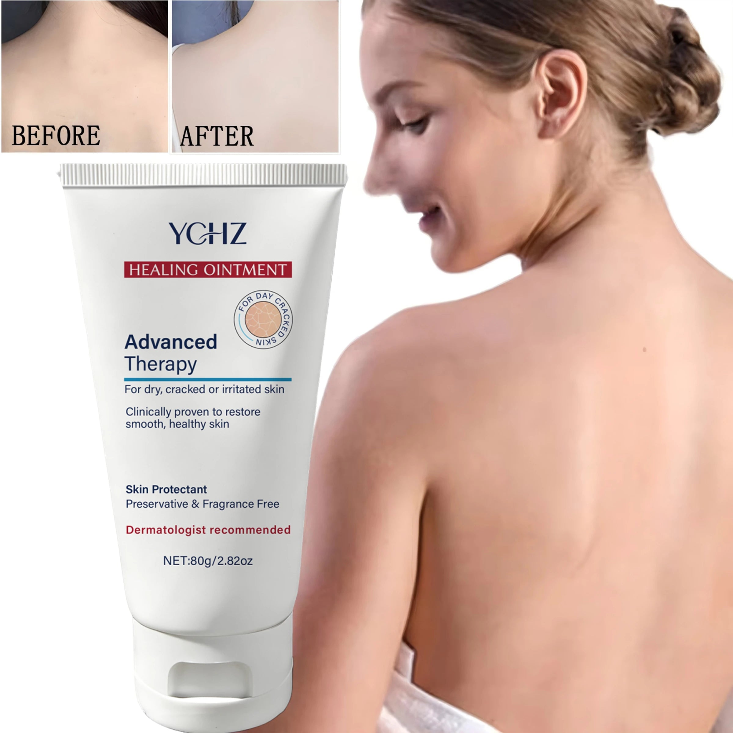 YCHZ Hydrating Body Cream – Shea Butter, Vitamin E & Hyaluronic Acid