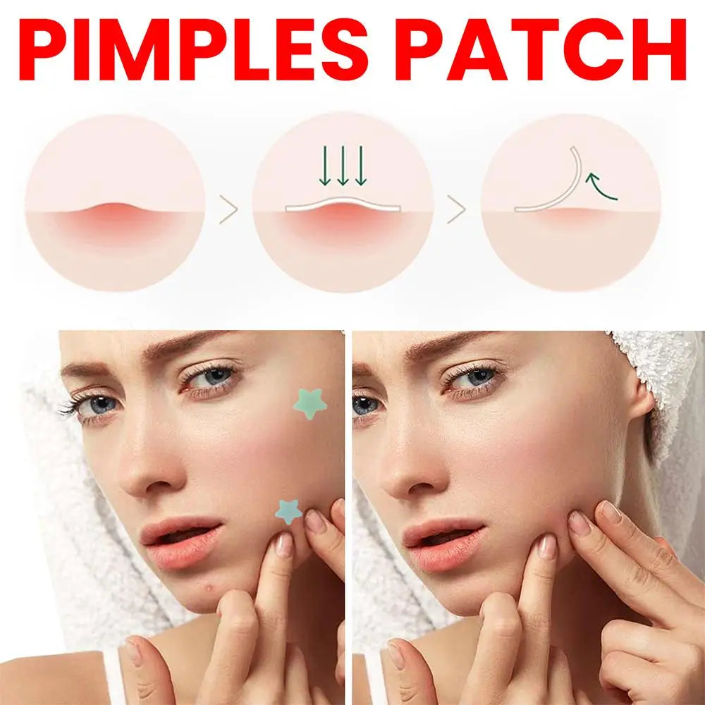 200pcs Star Shape Pimple Patches Colorful Hydrocolloid Pimple Healing Sticker Cute Strong Absorption Zit Patches Face Care Oasis Select