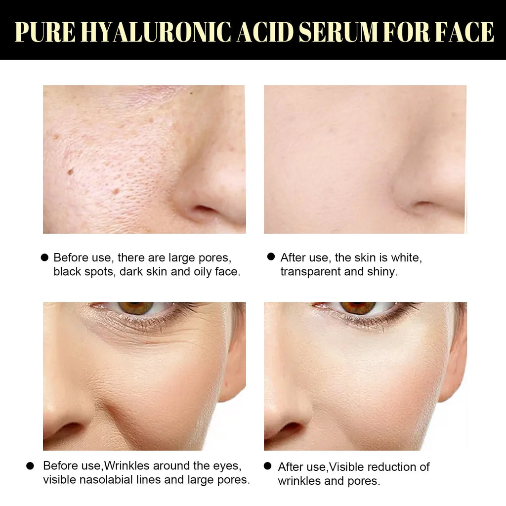 Hydrolyzed Collagen Protein Threads Fade Face Fine Lines Lift Firming Shrink Pores Deep Repair Absorbable Face Filler Skincare Oasis Select