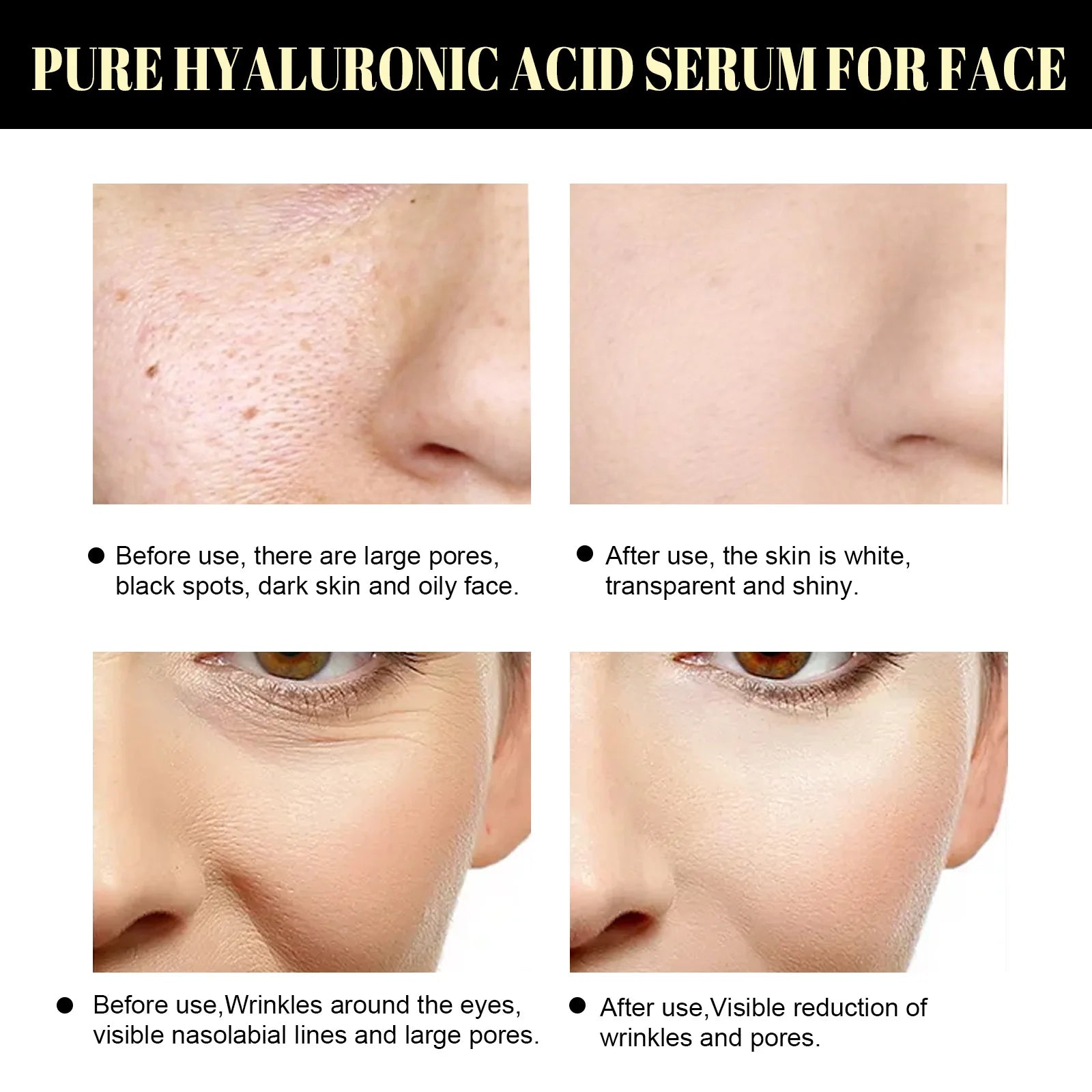Hydrolyzed Collagen Protein Threads Fade Face Fine Lines Lift Firming Shrink Pores Deep Repair Absorbable Face Filler Skincare Oasis Select
