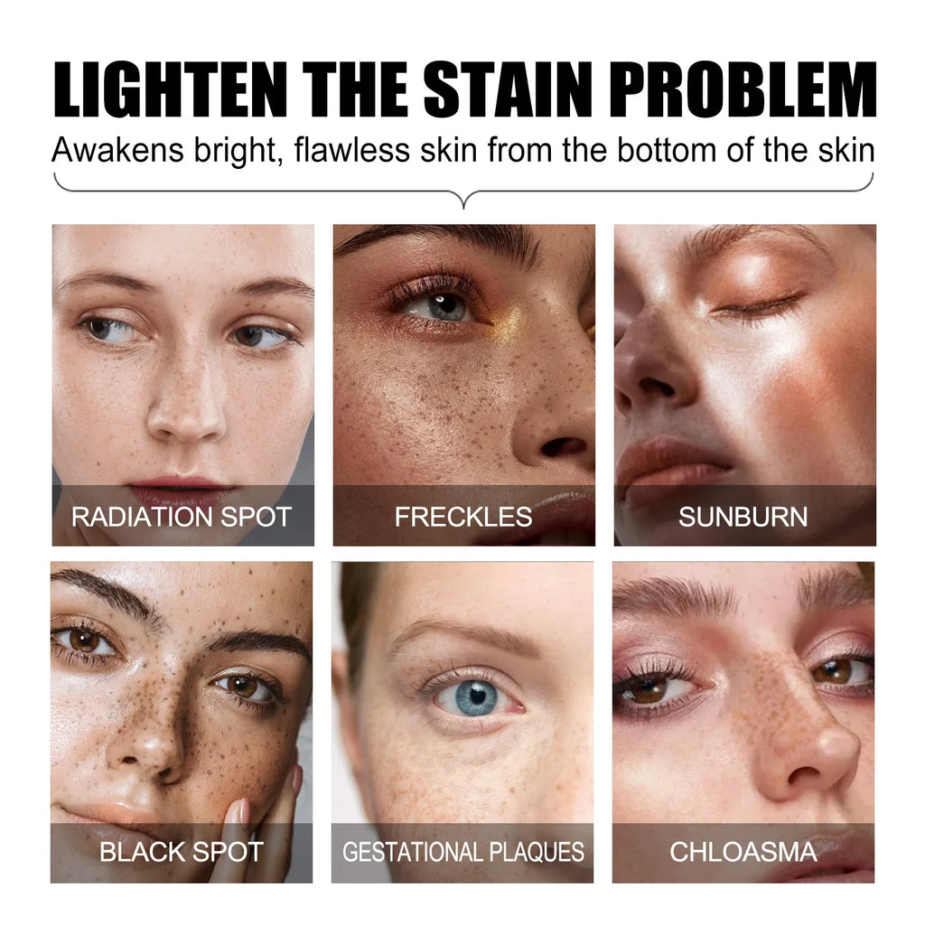Jaysuing Brightening Serum – Dark Spot & Pigmentation Corrector