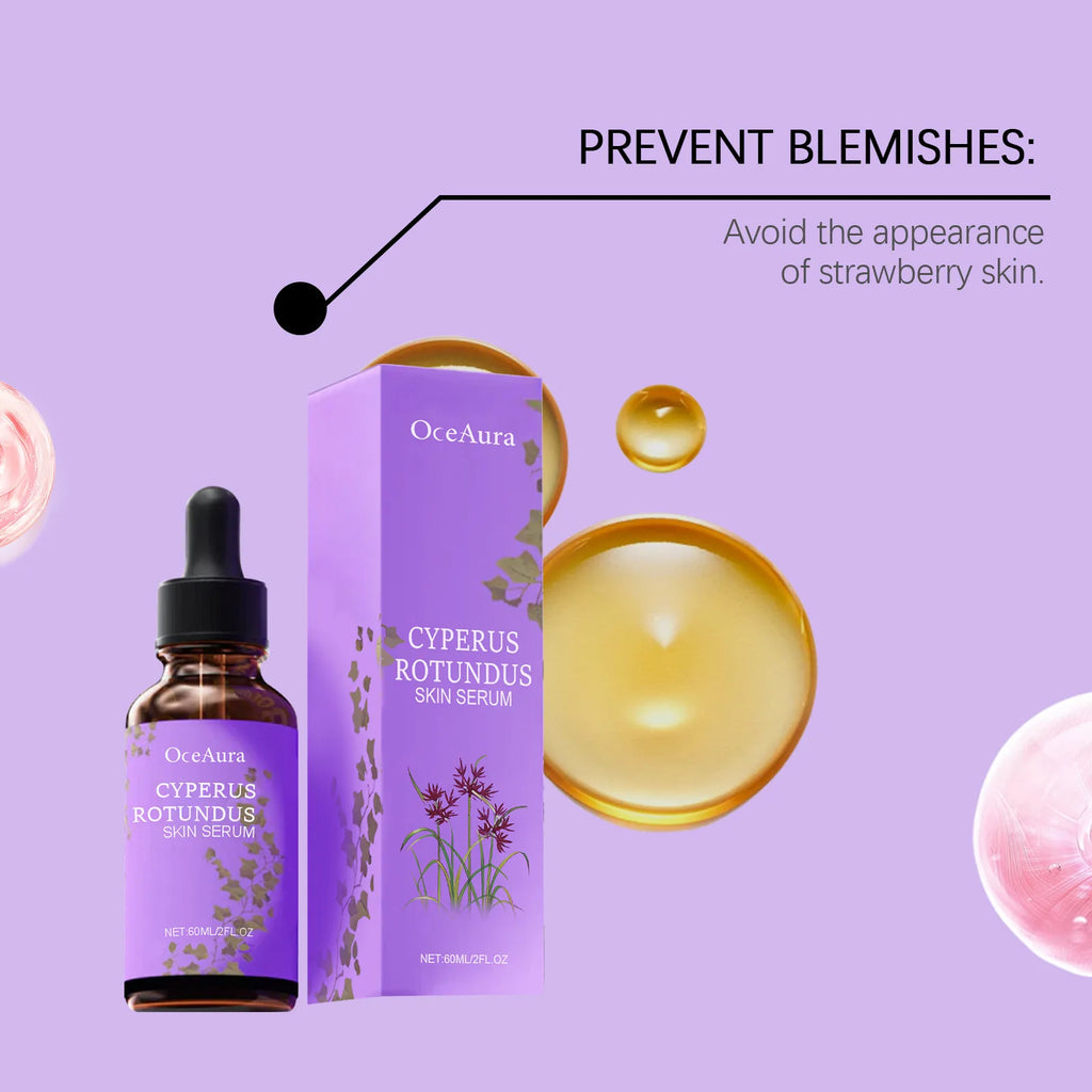 Cyperus Rotundus Serum Hair Growth Inhibitor Soothing Moisturizing Depilatory Refreshing Slowing Reduction Body Hair Growing Oil Oasis Select