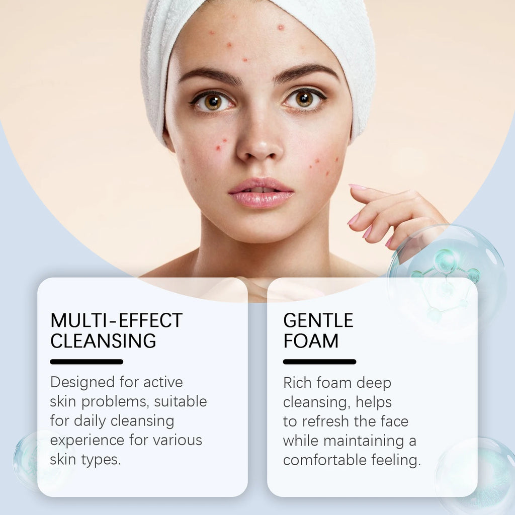 Salicylic Acid Facial Cleanser Acne Treatment Moisturizing Oil Control Skincare Face Wash Cleansing Pore Hydrating Skin Care Oasis Select