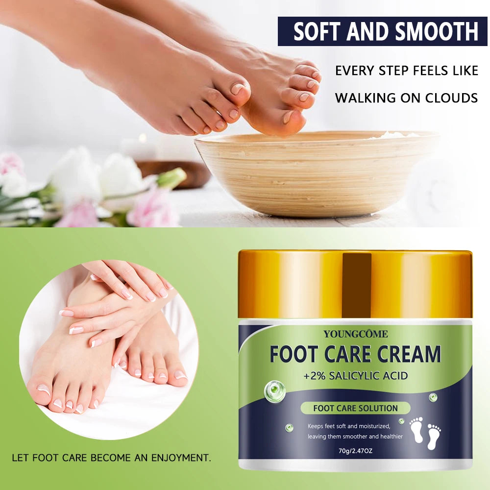 YOUNGCOME 2% Salicylic Acid Foot Cream – Moisturizing & Softening