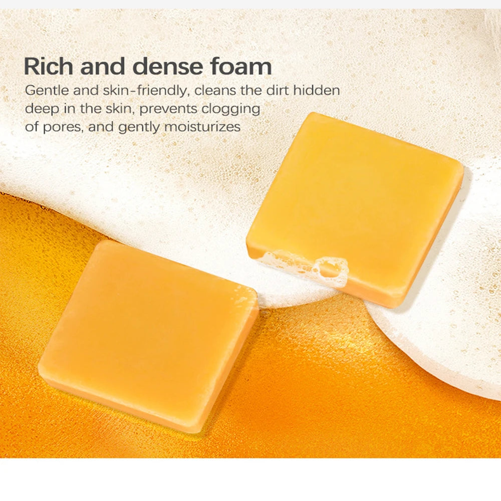Turmeric Handmade Bar Soap 110g – Oil Control & Bright Skin
