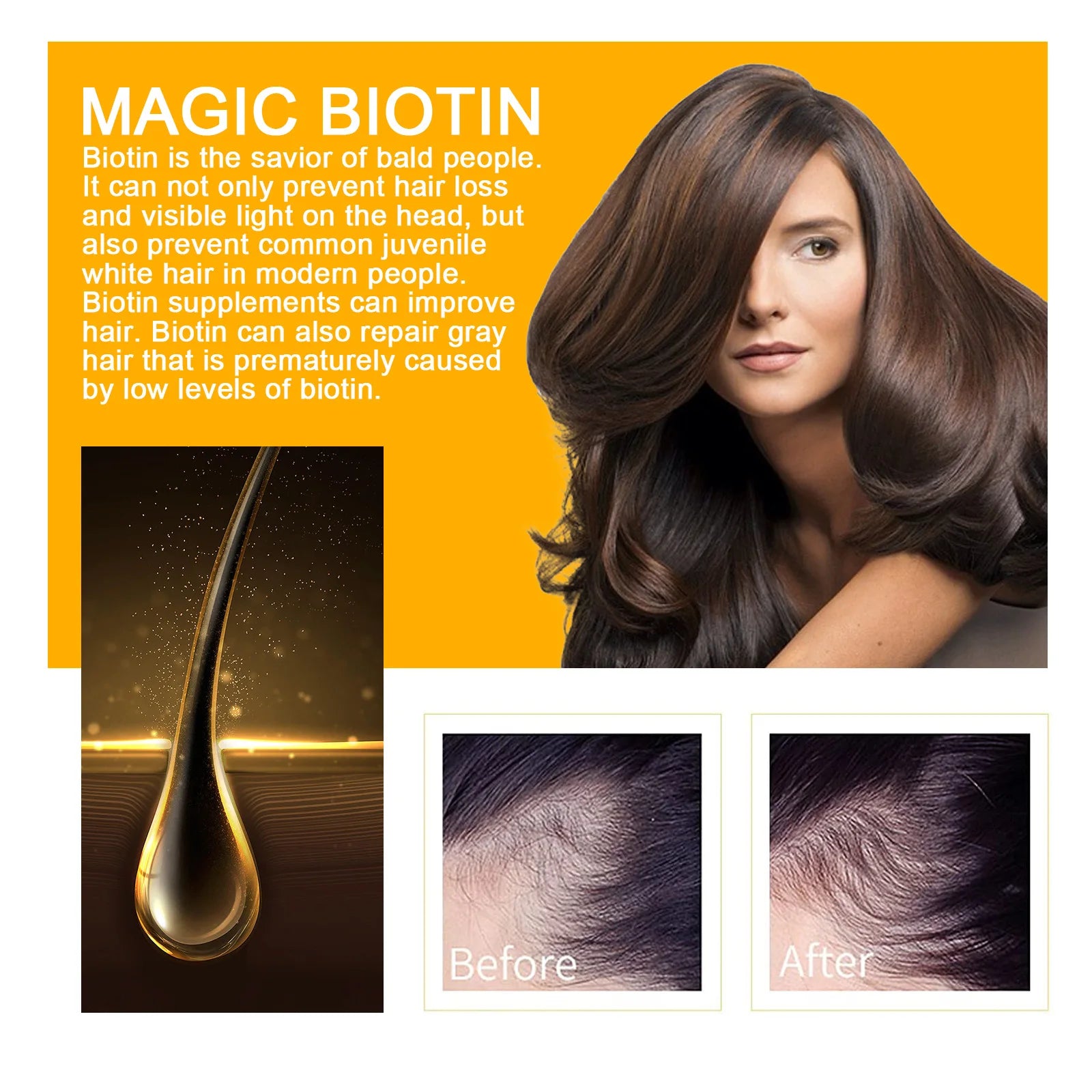 EELHOE Biotin Hair Spray For Man Women 30ml Hair Growth Repair Damage Restore Oil Scalp Repair Serum Spray Thicken Hair Care Oasis Select