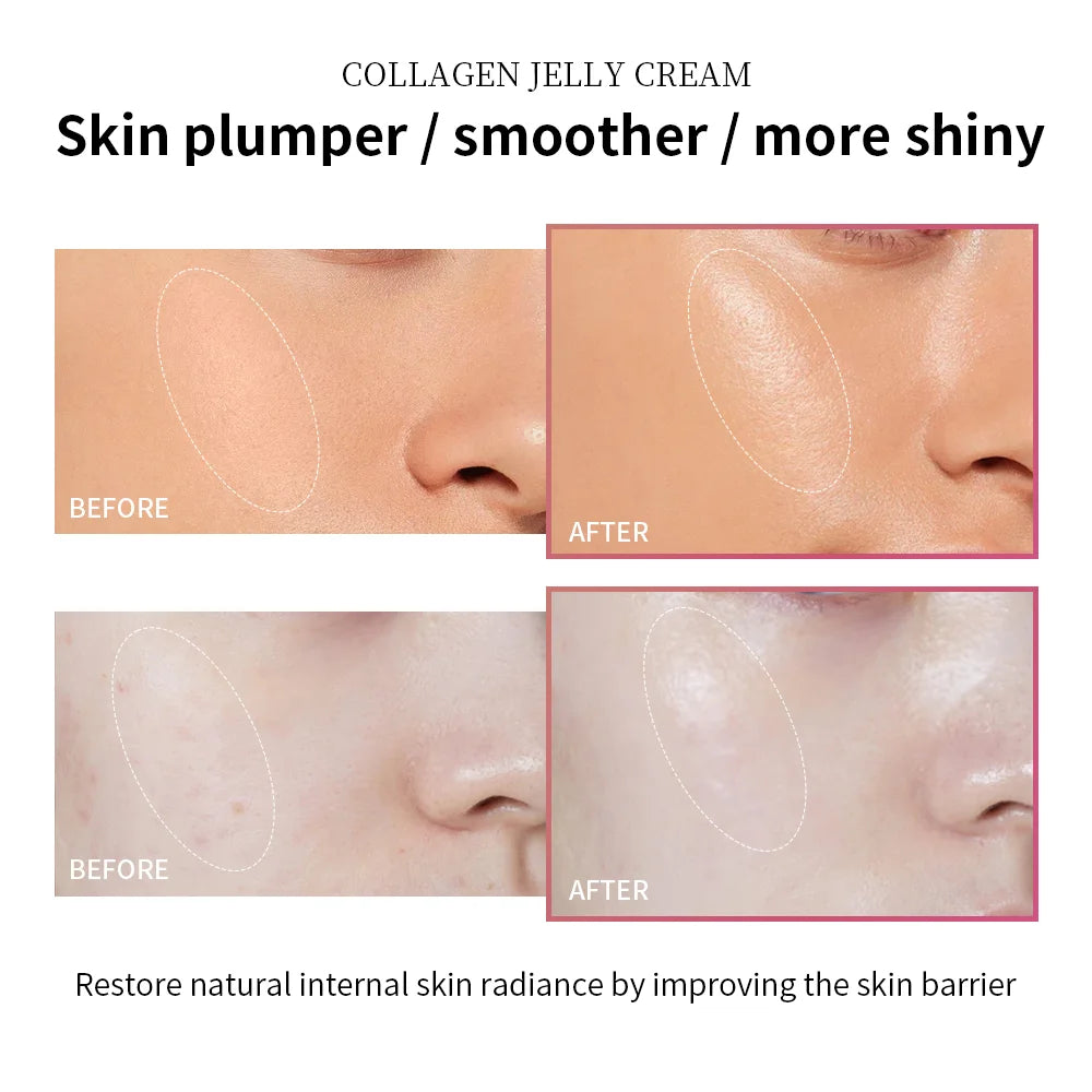 100ml Collagen Jelly Cream Niacinamide Tightening Soothing Moisturizing Anti-Aging Firmness Hydration Skincare 100ml Face Gel Oasis Select