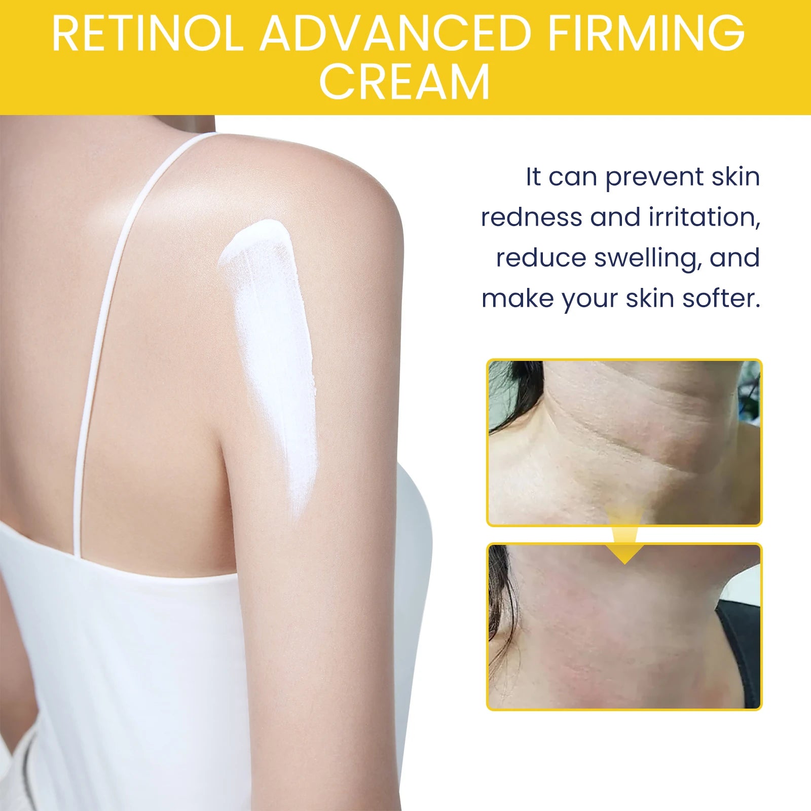 Retinol Body Cream – Firming, Brightening & Moisturizing | 100g