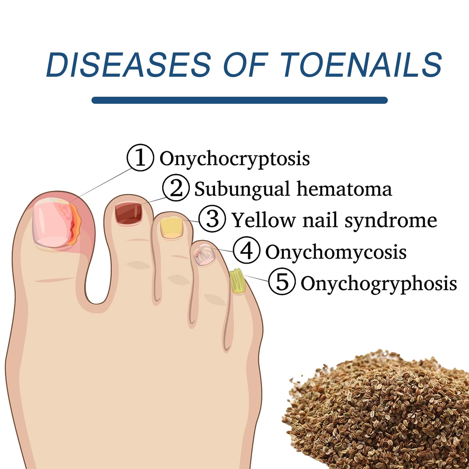 32-Piece Ingrown Toenail Correction Patches & Nail Repair Stickers