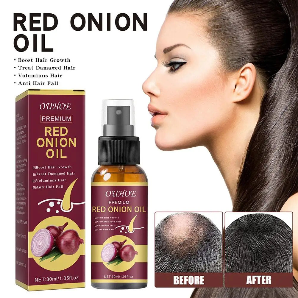Red Onion Hair Oil Spray – Nourish Roots & Reduce Hair Loss