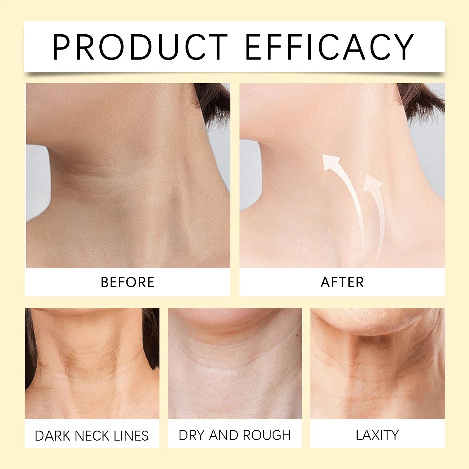 Bee-Venom Neck Care Stick Contains Collagen Lift & Tighten Skin Lighten Neck Lines Double Chin Moisturizing Beauty Neck Cream Oasis Select
