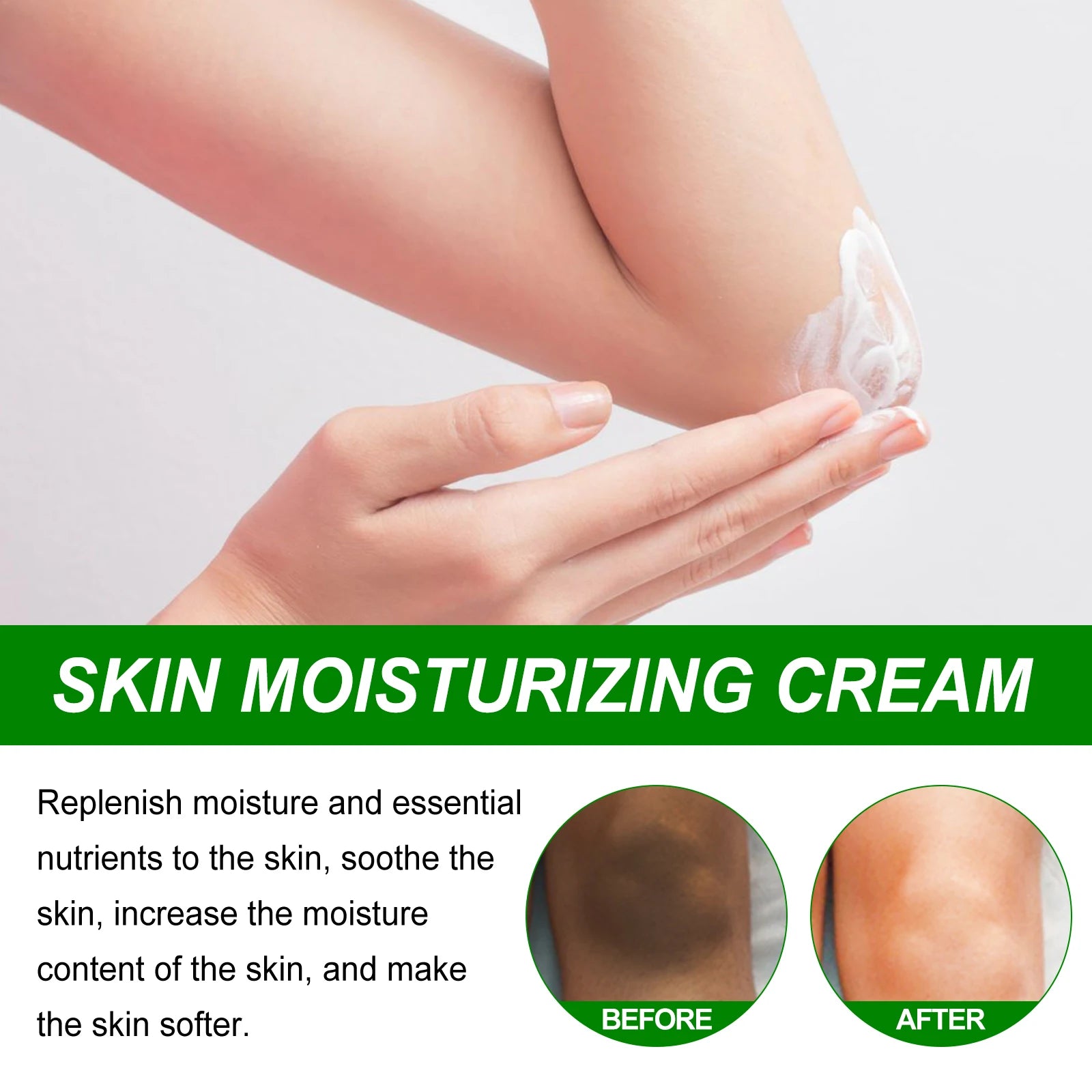 Retinol Whitening Cream for Dark Skin Knee Buttocks Underarm Butt Inner Brightening Private Part Remove Melanin Bleaching Cream Oasis Select