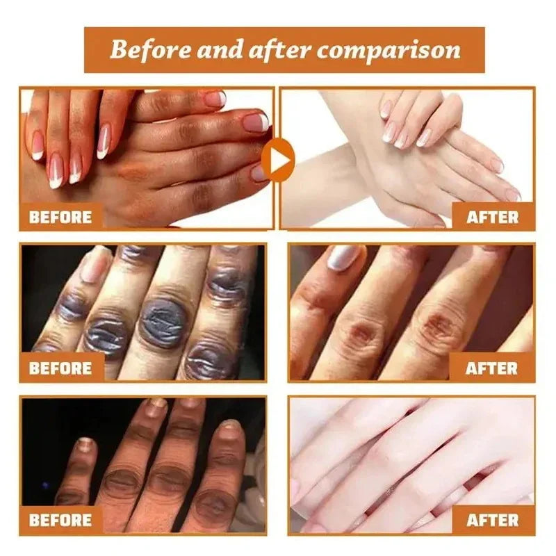 Brightening Hand Cream – Dark Knuckle & Skin Tone Corrector