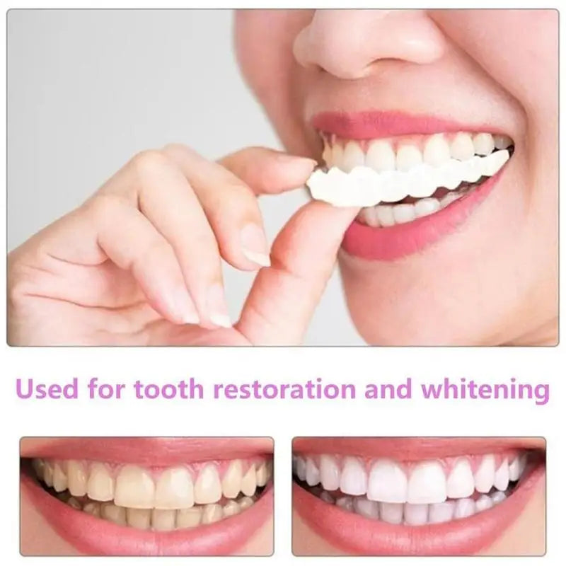 Snap-On Teeth Veneers – Reusable Smile Cover for Men & Women Cosmetic Dental Veneers Oasis Select