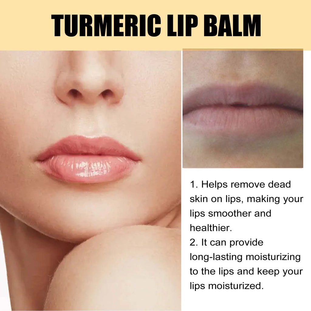 Eelhoe Turmeric Lip Balm – Darkness Removal & Moisturizing Turmeric Lip Balm Oasis Select