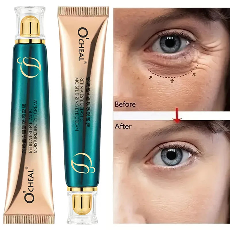 Retinol A Ester Elastic Moisturizing Firming Eye Cream Fading Fine Lines Dark Circles 30g Oasis Select